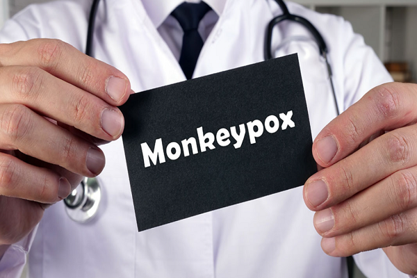 اختبار الكشف عن المستضد السريع: خمسة أشياء تحتاج إلى معرفتها عن monkeypox
